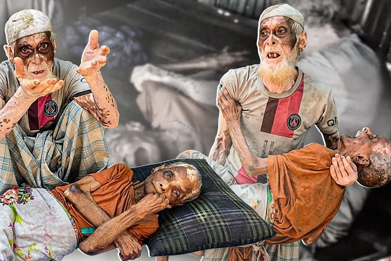 ৭০ বছরের সংসার, স্ত্রীকে আঁকড়ে ধরেই অভাবের সঙ্গে লড়ছেন সাজু শেখ